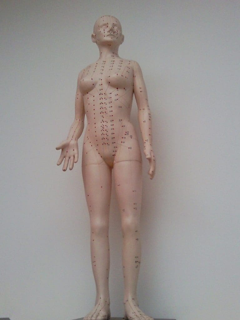 The Benefits Of Acupuncture For Pain Relief