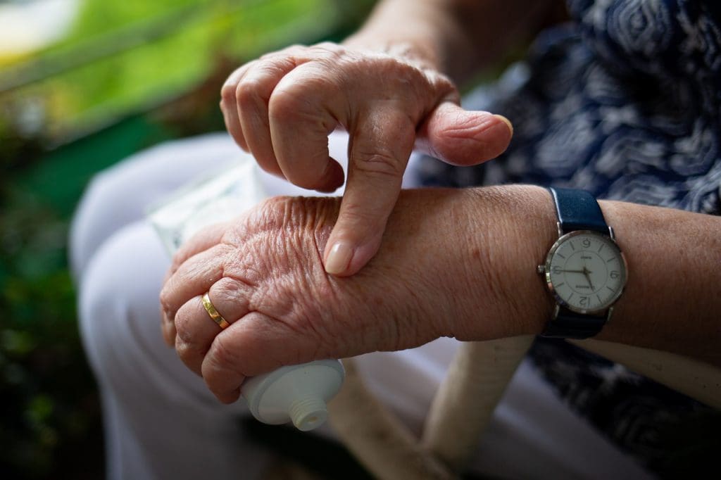 Understanding And Managing Rheumatoid Arthritis