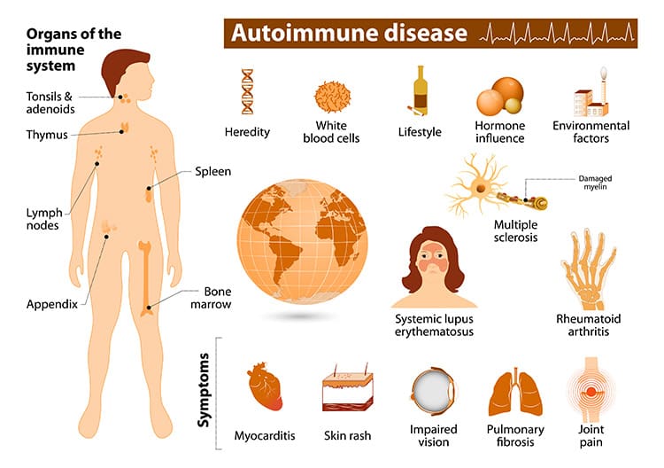 The Ultimate Guide To Living With Chronic Immune Disorders