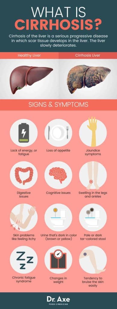 Top Tips For Living With Chronic Liver Disease Top Tips For Living With Chronic Liver Disease