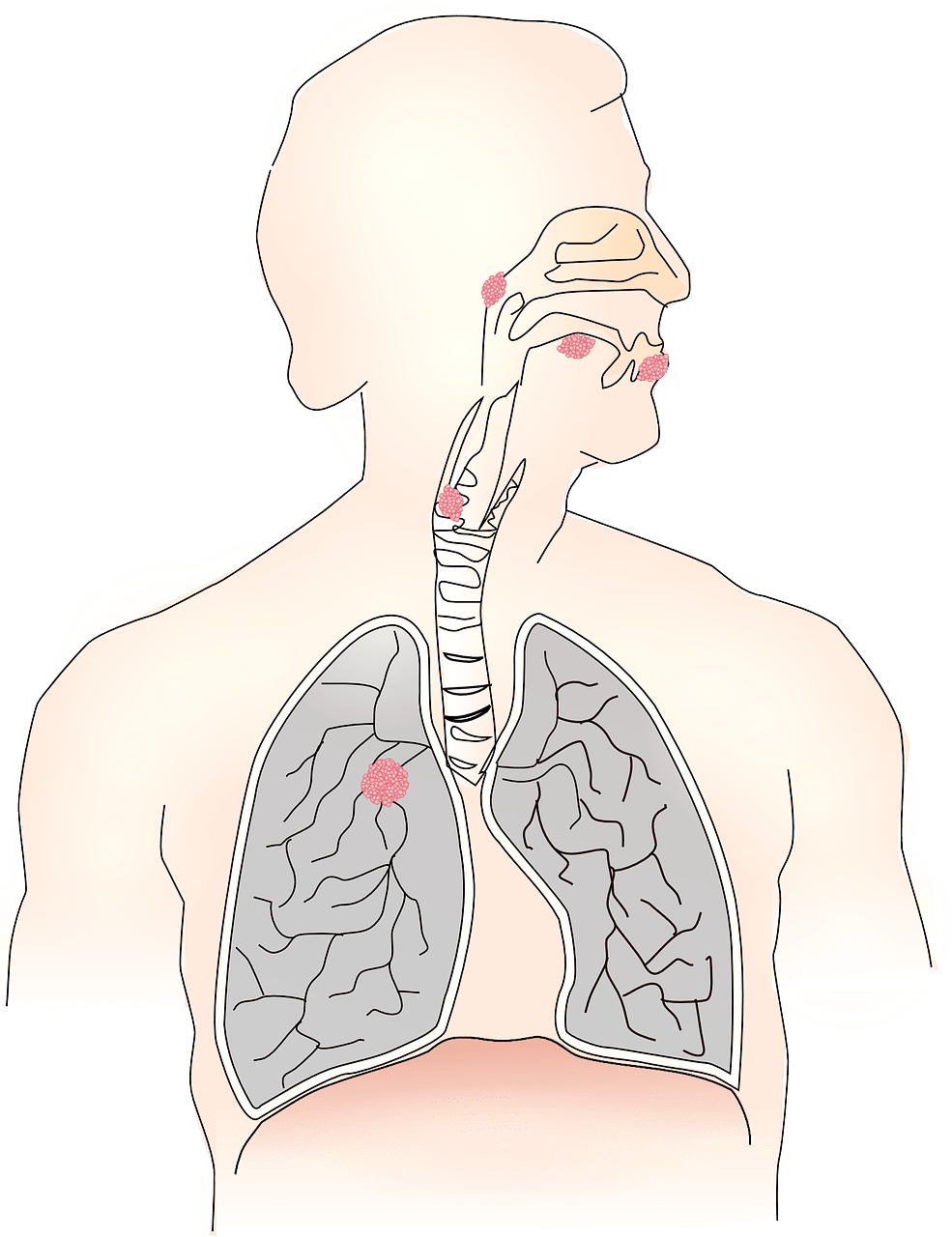 10 Tips For Preventing Common Respiratory Illnesses