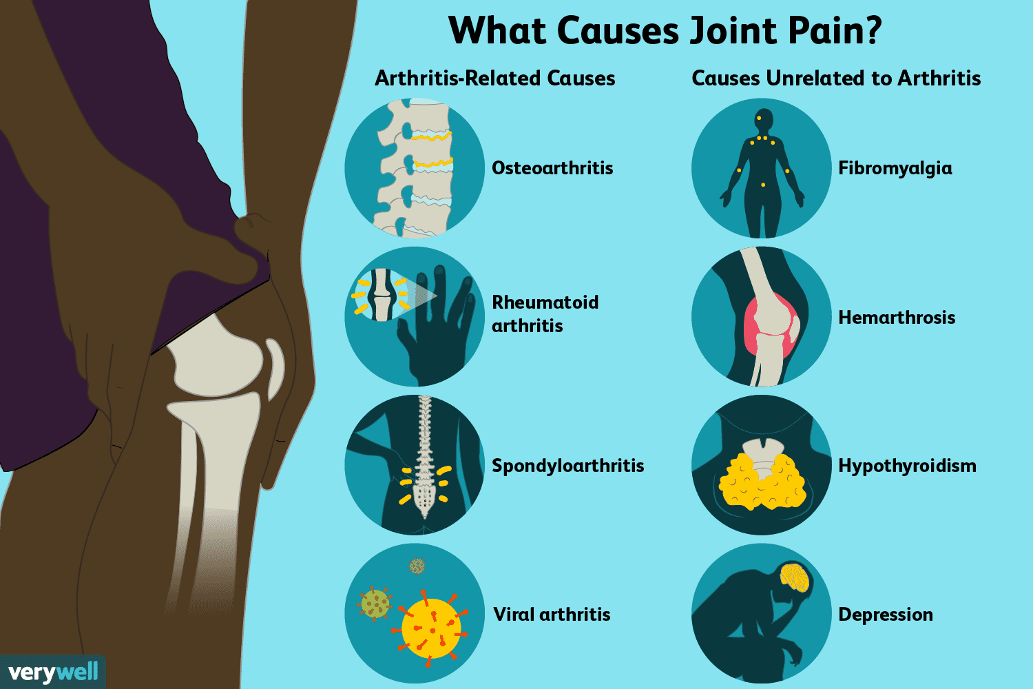 Best Practices For Preventing Muscle And Joint Pain