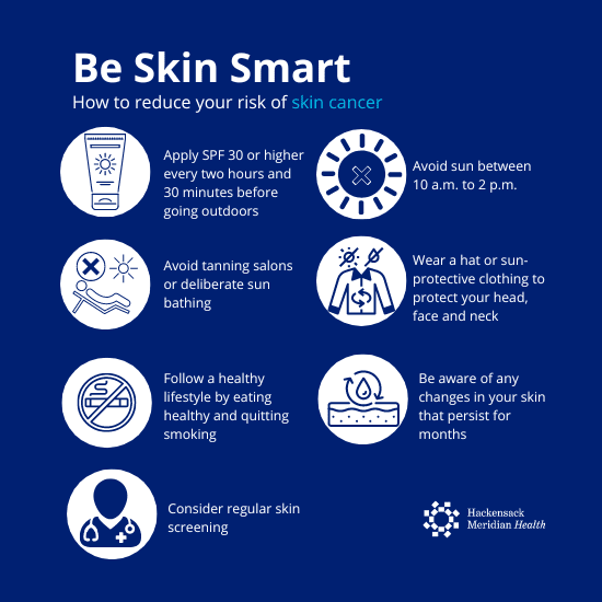 Best Practices For Preventing Skin Cancer