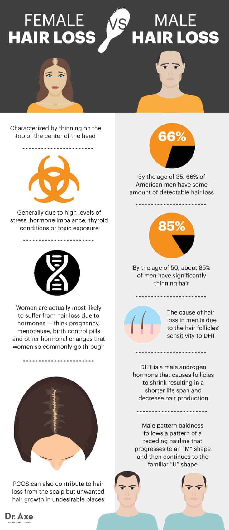 Essential Tips For Dealing With Female Hair Loss