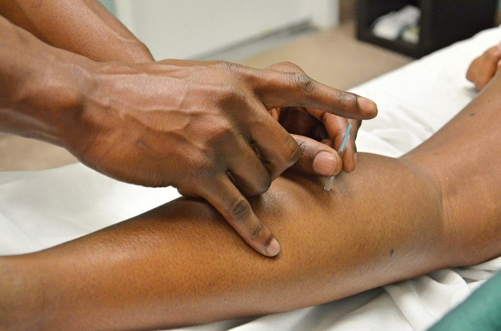 Key Benefits Of Acupuncture As An Alternative Medicine