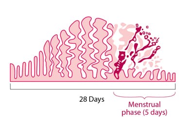 Navigating The Challenges Of Chronic Menstrual Disorders