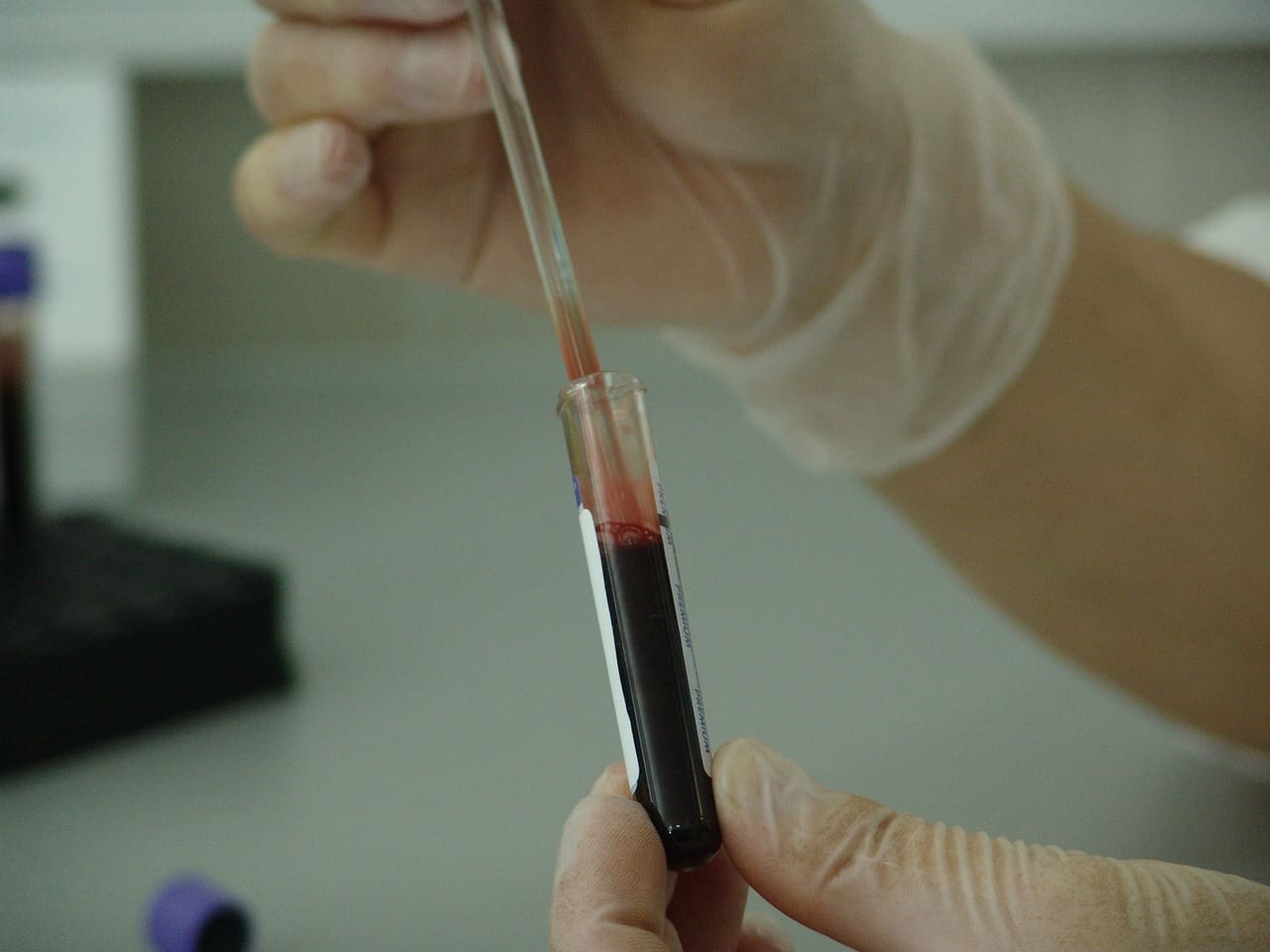 Understanding Genetic Testing For Chronic Conditions: Counseling And Decision-Making