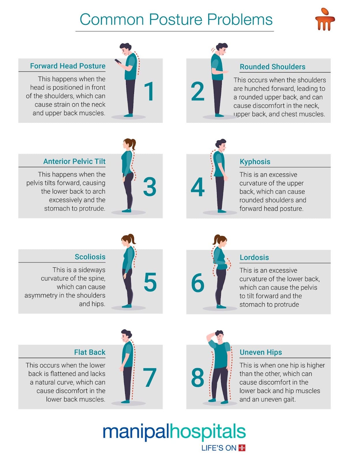 Best Workouts For Improving Posture
