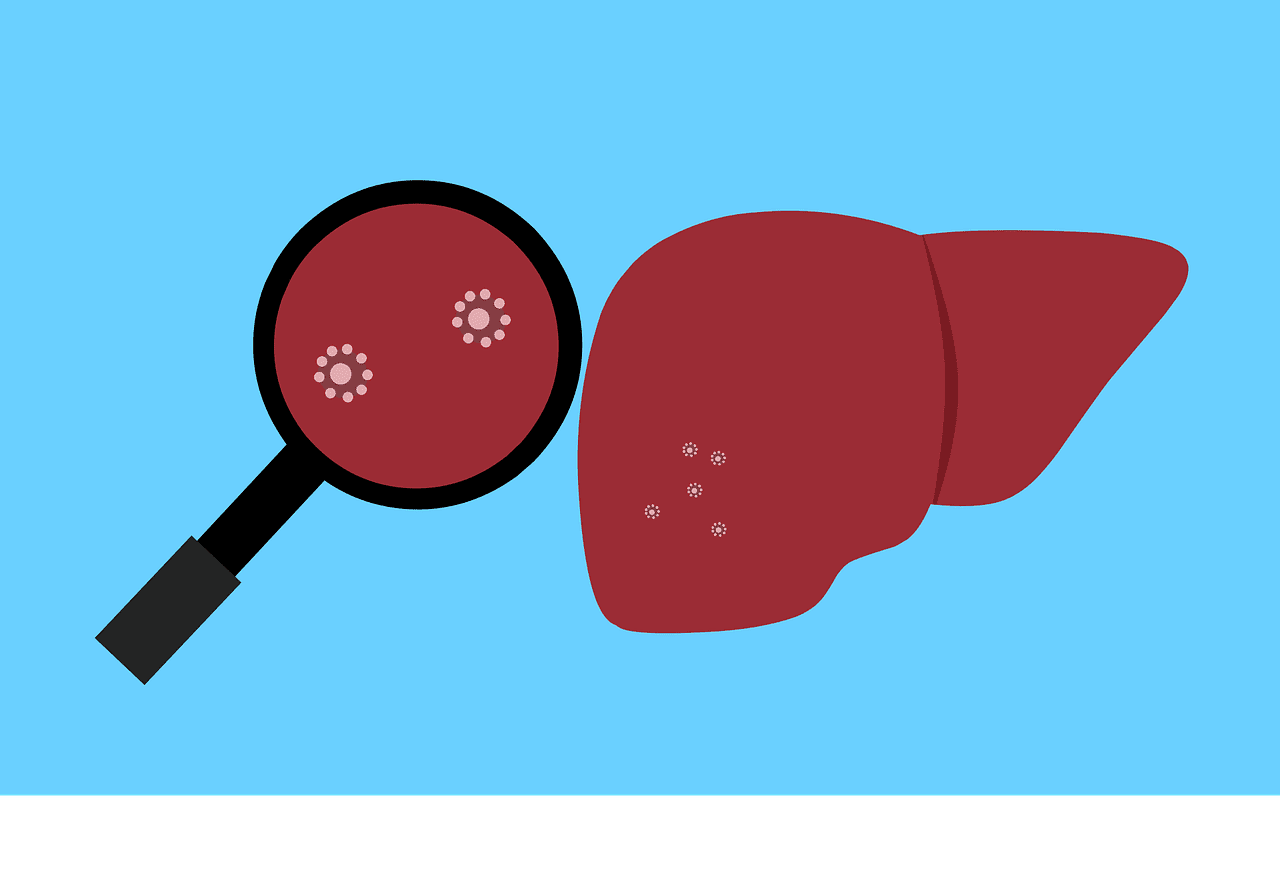 Effective Ways To Manage Chronic Hepatitis