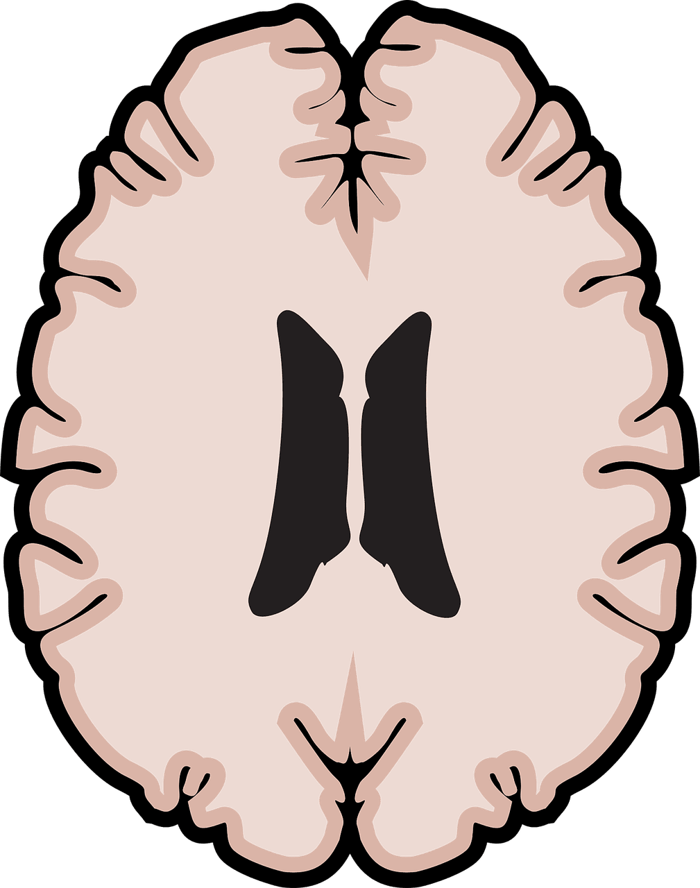 How To Prevent And Manage Multiple Sclerosis
