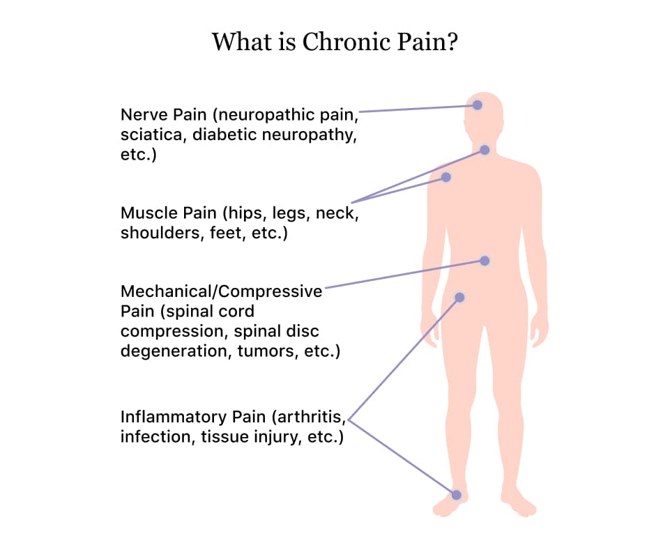 Longevity And Chronic Pain Management: Finding Relief
