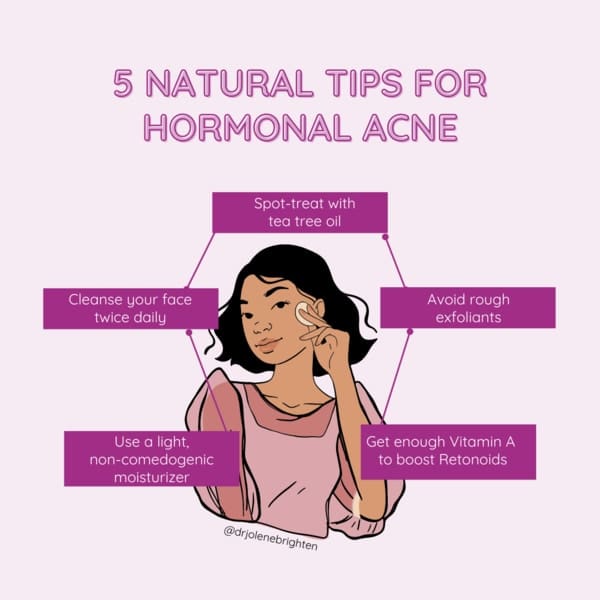 What Are The Best Practices For Hormonal Acne Treatment In Women?