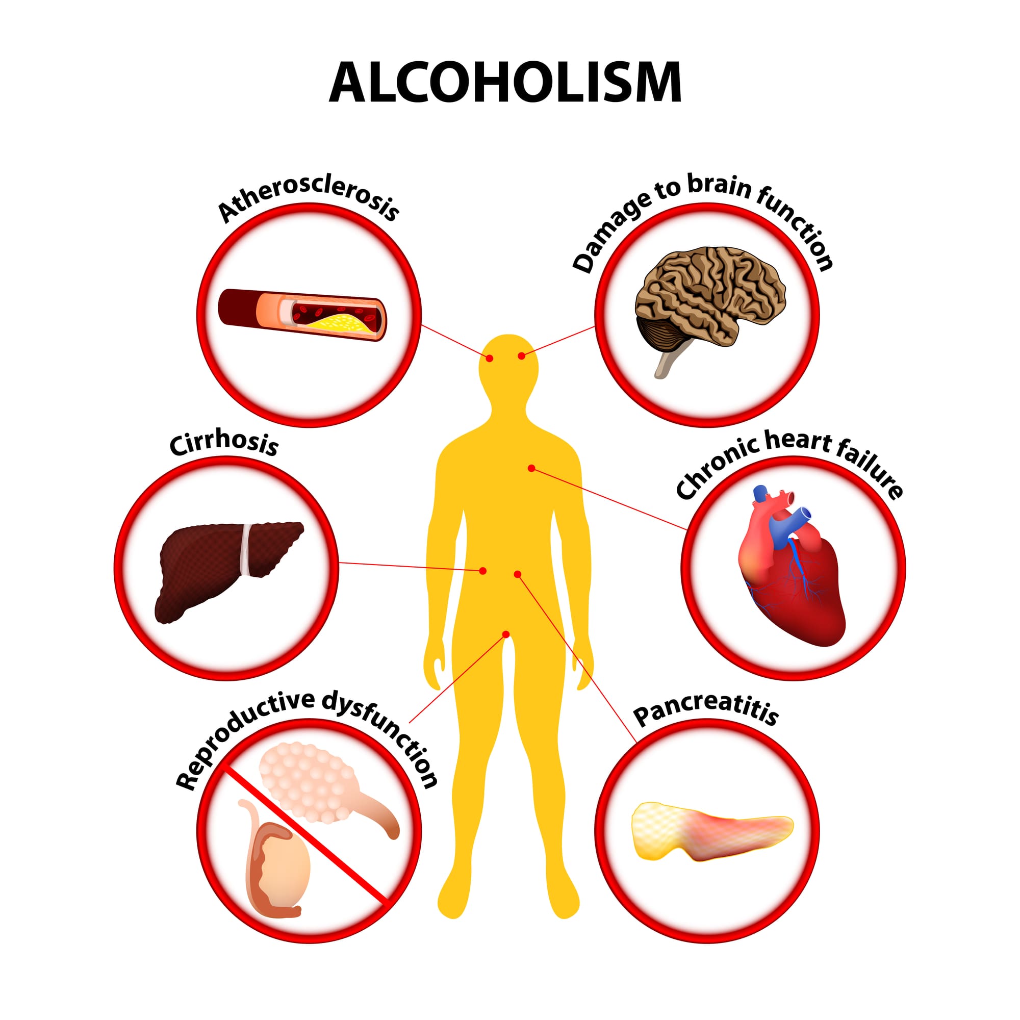 Beginner’s Guide To Understanding The Impact Of Alcohol On The Body And Strategies For Moderation