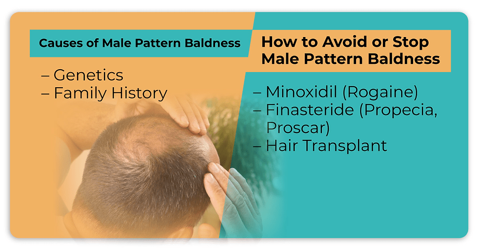 Understanding The Risks Of Male Pattern Baldness