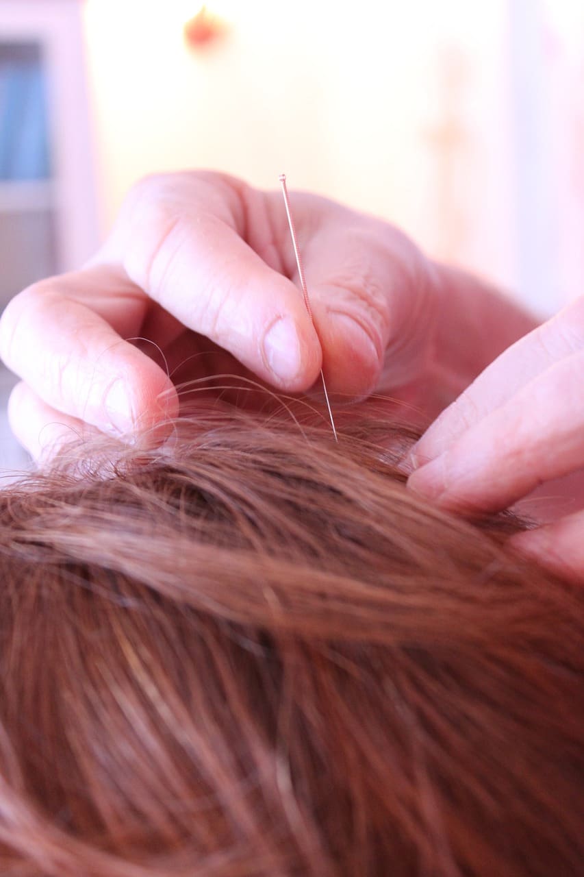 Exploring The Benefits Of Acupuncture For Holistic Wellness Exploring The Benefits Of Acupuncture For Holistic Wellness