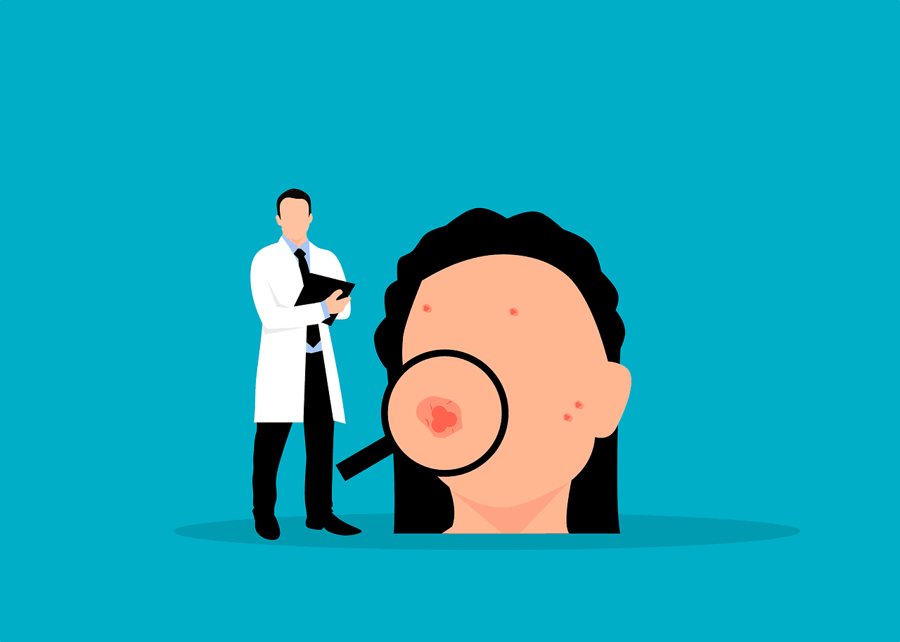 How To Manage Hormonal Acne Naturally
