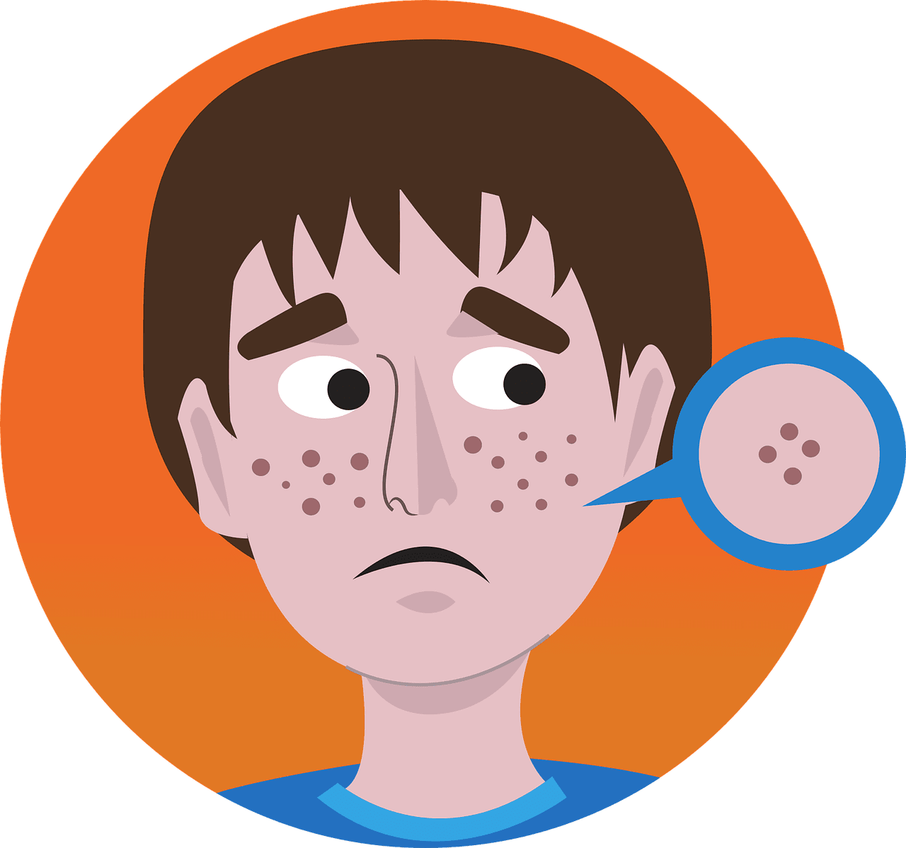 How To Manage Hormonal Acne Naturally