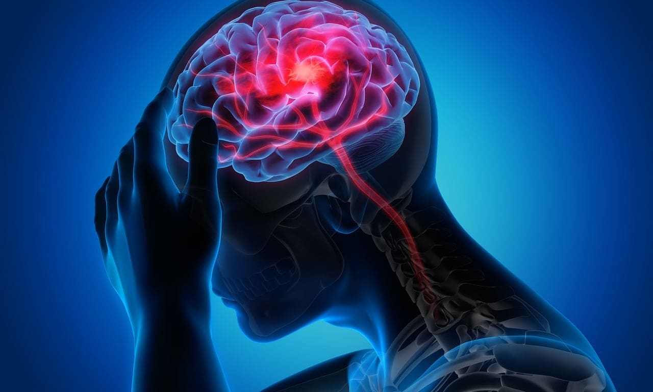 Top Ways To Treat Chronic Migraines Top Ways To Treat Chronic Migraines
